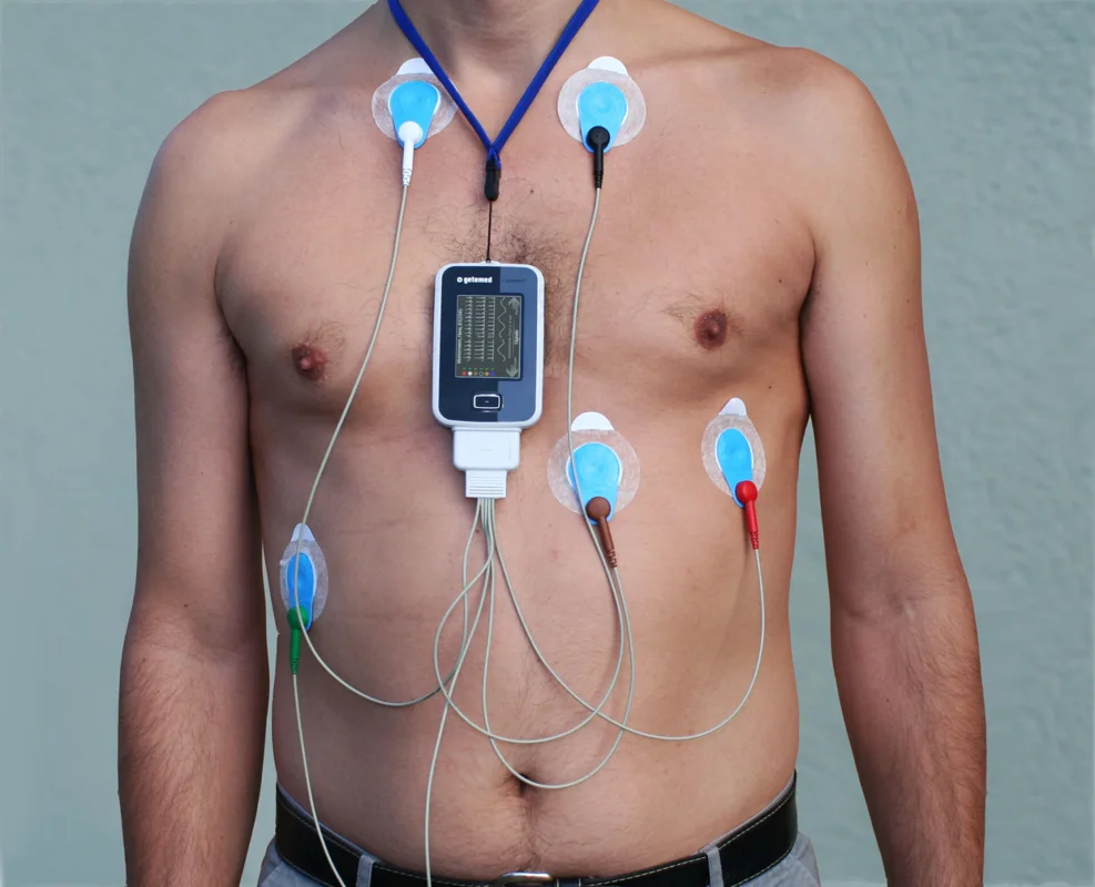Holter de 72 horas