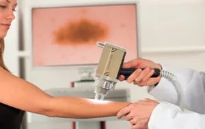 Dermatoscopia digital e mapeamento corporal (fotofinder)