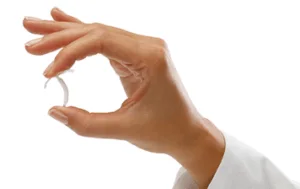 Implante e remoção de DIU hormonal