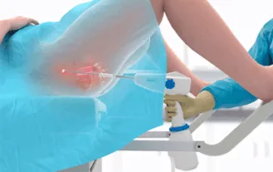 Cauterização química ou eletrocauterização de lesões vulvares, vaginais e do colo uterino
