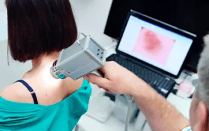 Dermatoscopia digital e mapeamento corporal (fotofinder)